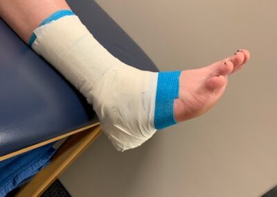 Ankle taping